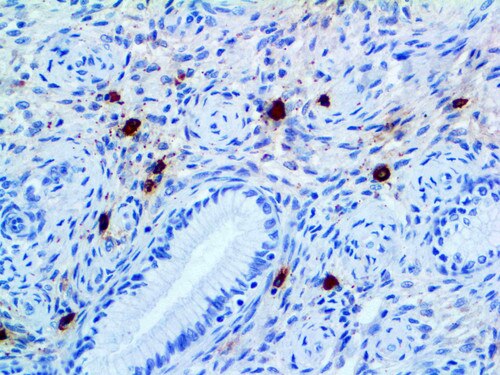 IHC of Tryptase Mmab on an FFPE Uterus Tissue